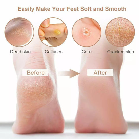 Foot Scrubber Electric Foot File Callus Remover Hard Skin Remover Pedicure Tools