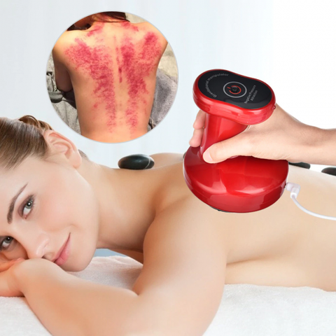 Electric cupping stimulate acupoint body slimming massager guasha scraping thermal massage negative pressure acupuncture therapy
