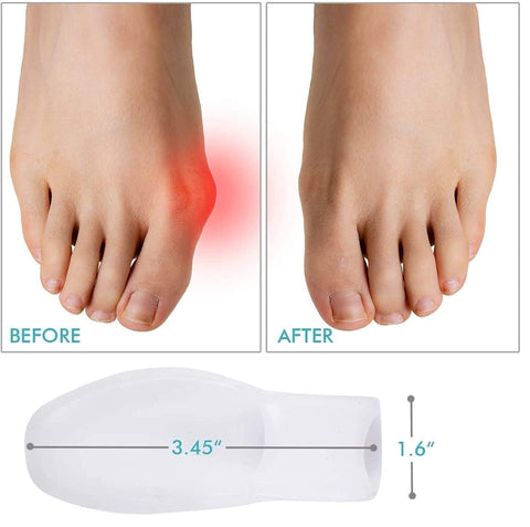 Gel Bunion Protector
