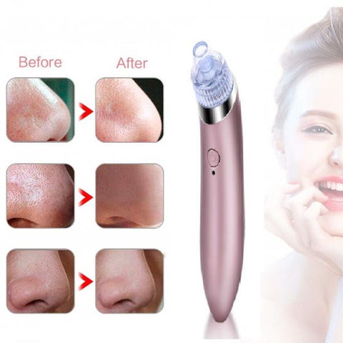 Blackhead Remover Device