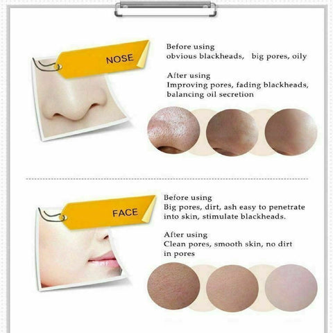 Black Mask Deep Cleaner