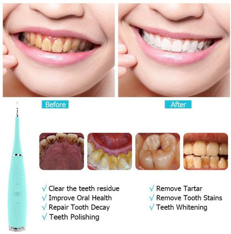 Electric Dental Scaler Tartar Calculus Plaque Remover Tooth Stains Cleaner Tool USB Powered