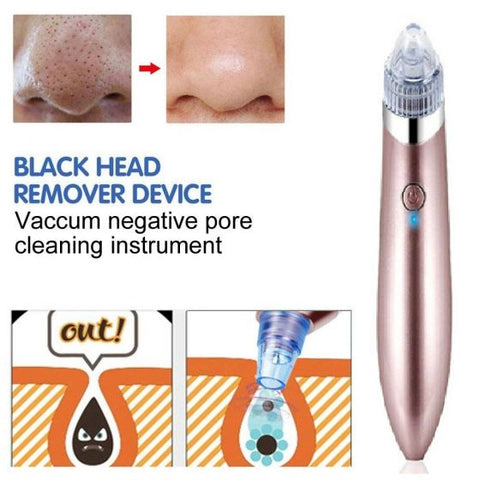 Blackhead Remover Device