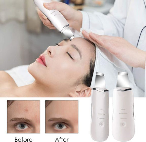 Derma Skin Scrubber Pen