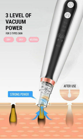 Blackhead Remover 6 Heads Face Electric USB Facial Pore Vacuum Derma Suction