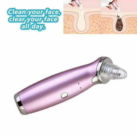 Face Facial Pore Blackhead Vacuum Derma Suction+Usb Charge Diamond Dermabrasion