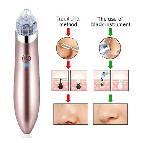 Blackhead Remover Device