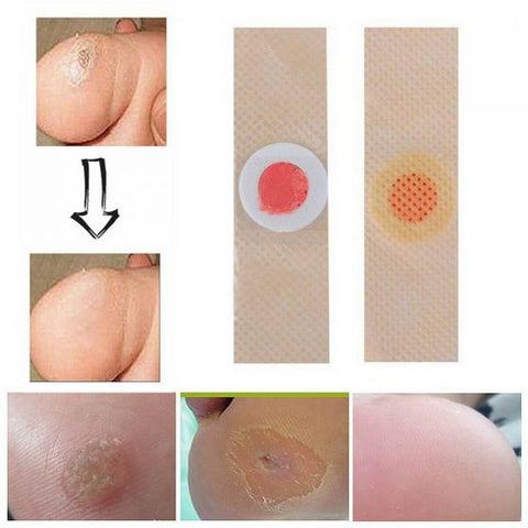 6Pcs Corn Remover Pads